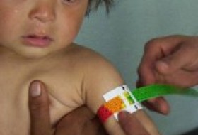 مرگ نوزادان در پی سوء تغذیه